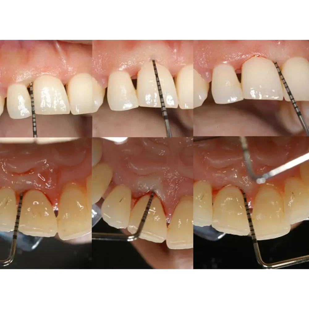 pcpunc15-1_1_2048x2048