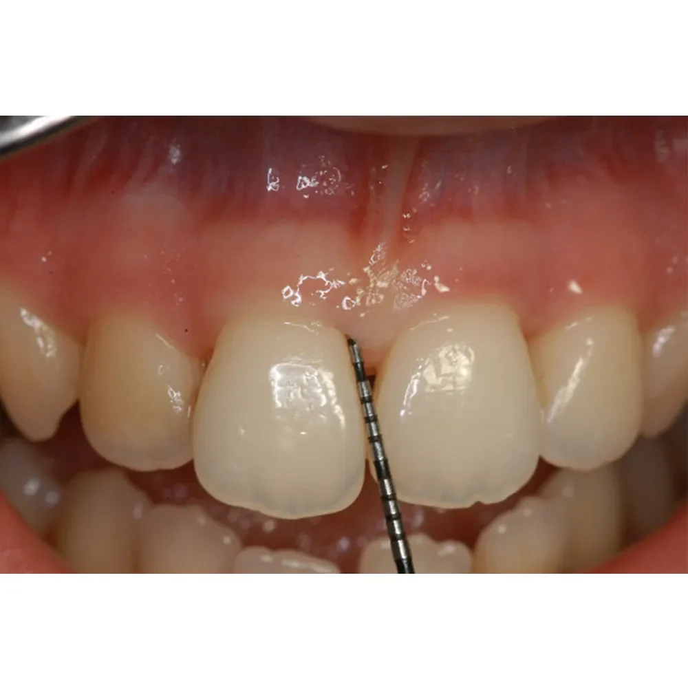 pcpunc15_1_2048x2048