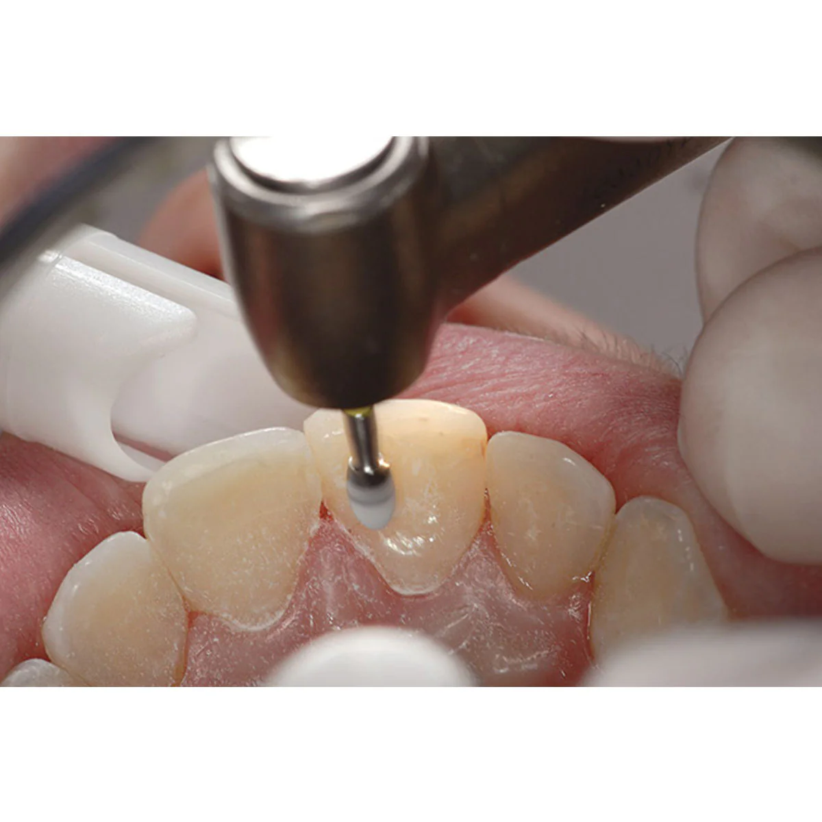 shofuCompositeFinishit5_2048x2048